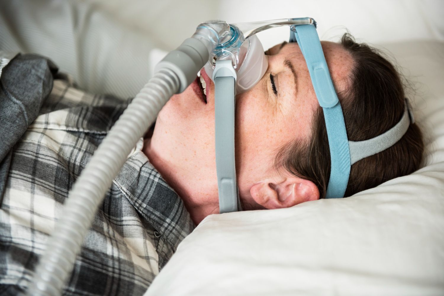 Sleep Apnea