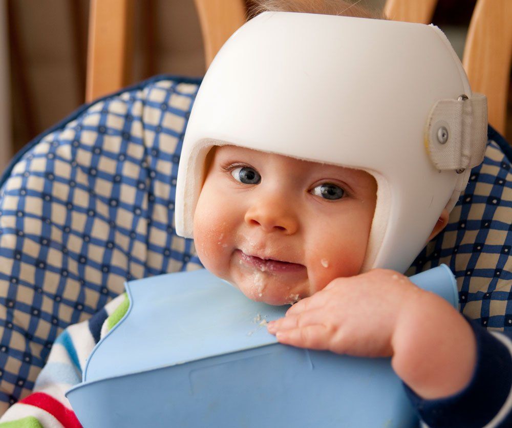 Baby With Cranial Helmet — Bullhead City, AZ — J.L. Artificial Limb & Brace Baby With Cranial Helmet — Bullhead City, AZ — J.L. Artificial Limb & Brace
