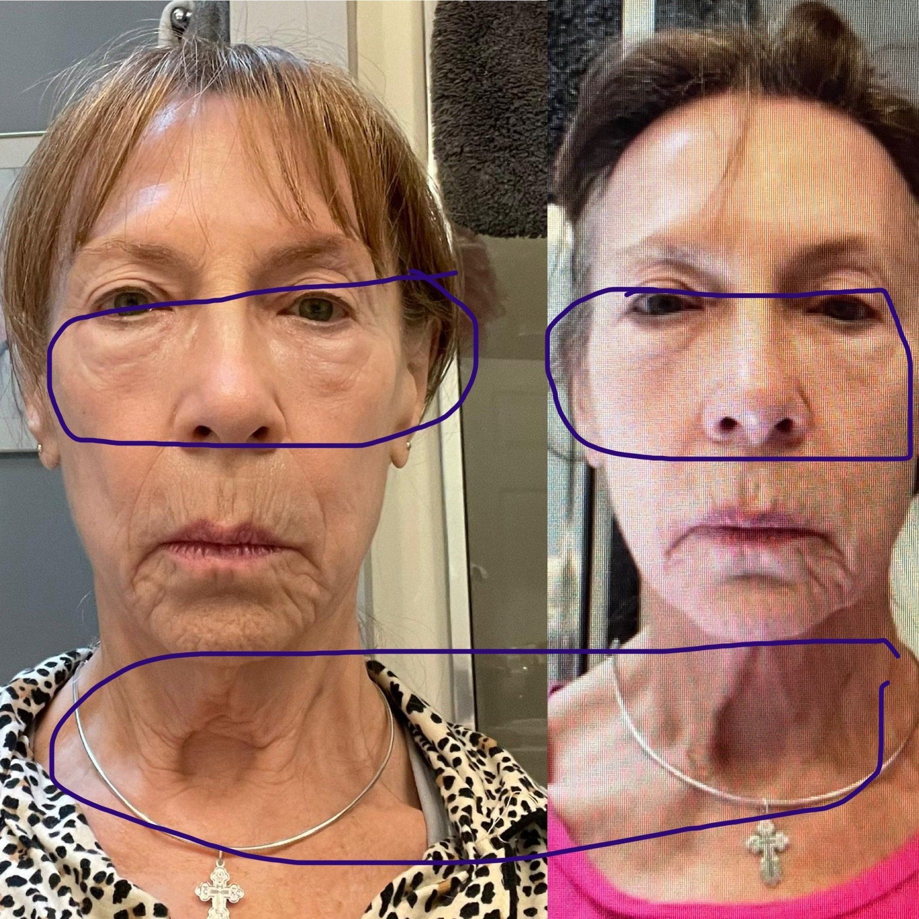 Face Yoga Case Study