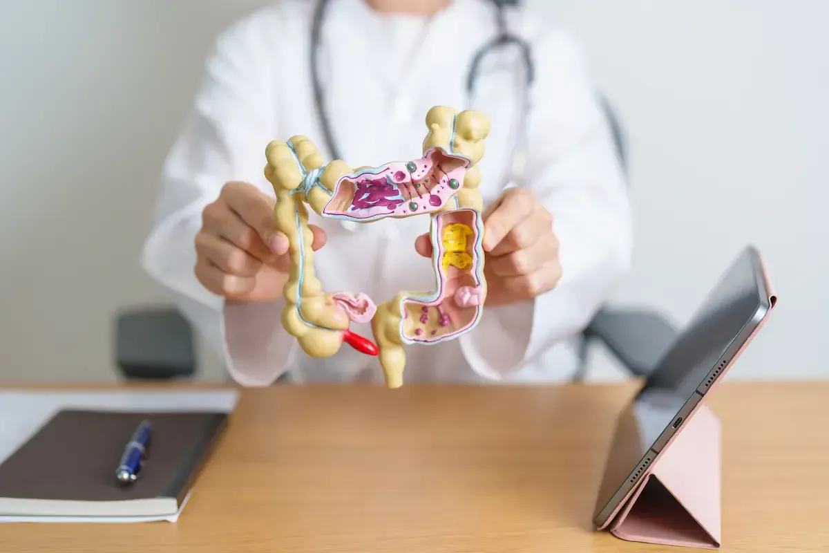 Doctor holding diagram to explain colonoscopy.