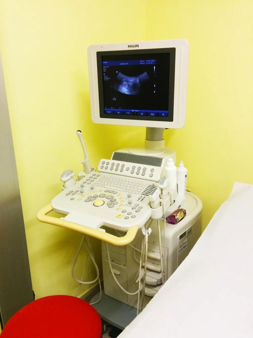 Ecografo con monitor e sonda in una sala visite gialla.