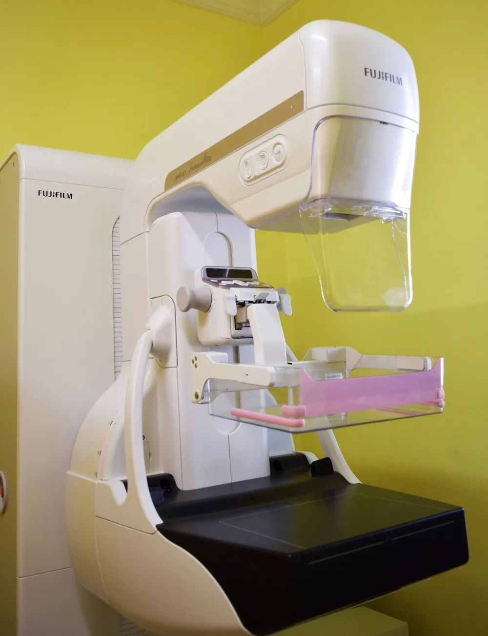 Apparecchio mammografico Philips bianco con piattaforma per il seno rosa su sfondo giallo.