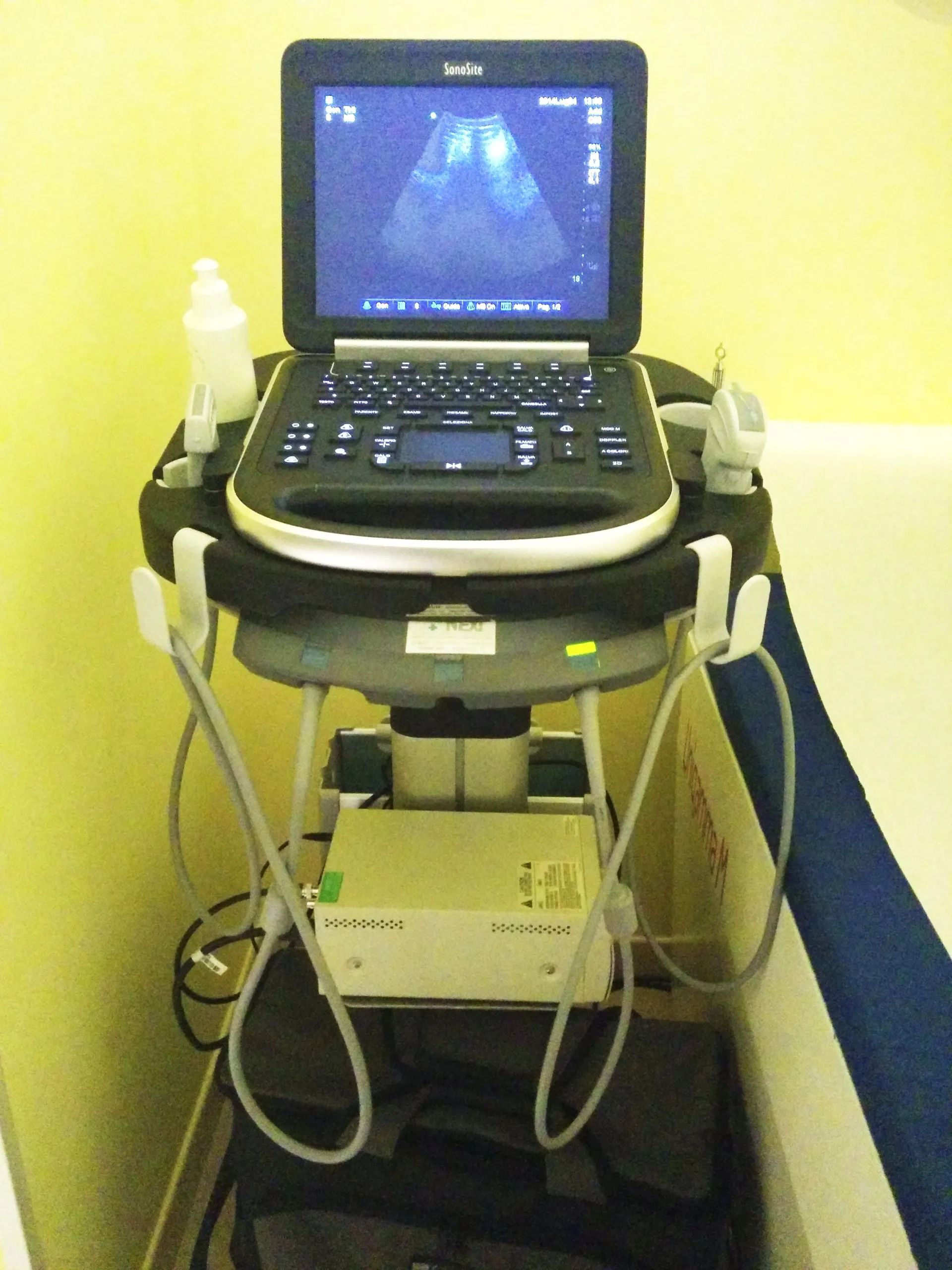 Computer portatile su un carrello medico che mostra un'ecografia in un ambiente clinico.