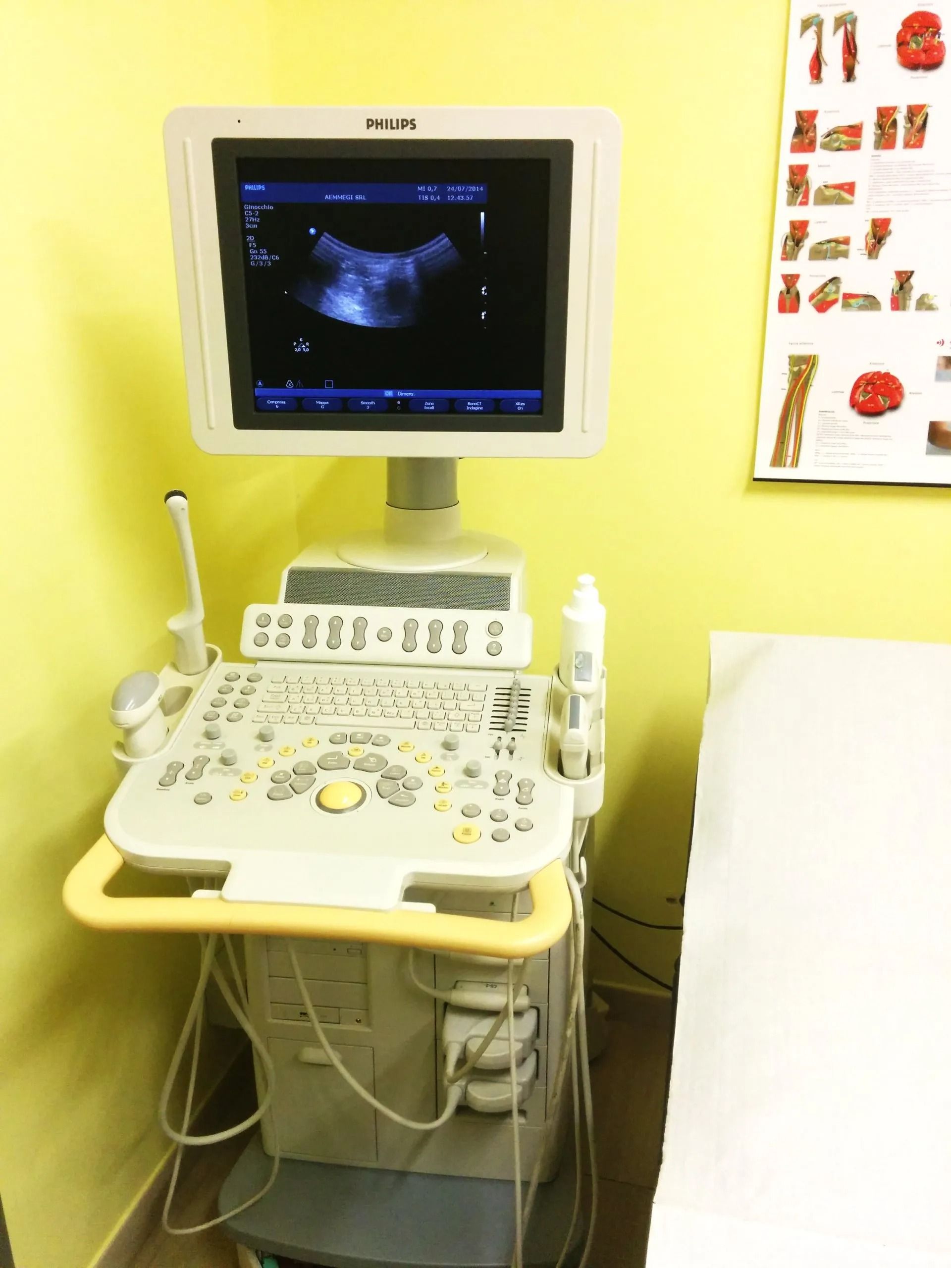 Apparecchio ecografico in una clinica con monitor scuro e pannello di controllo bianco su una parete gialla.