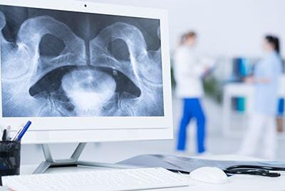 DR. ENRIQUE RODARTE FERNÁNDEZ DE CASTRO - PROBLEMAS DE OSTEOPOROSIS