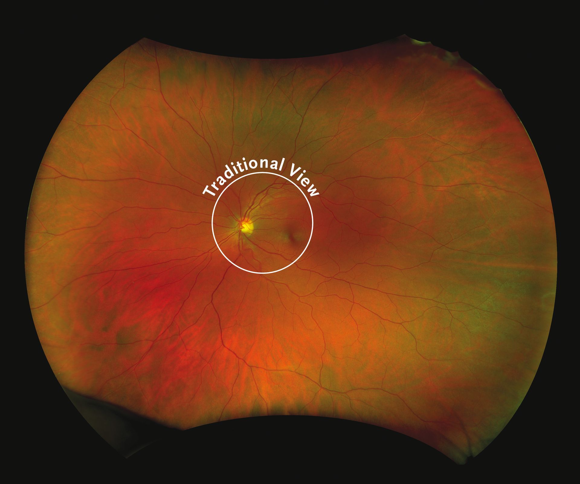Optos Sample  - Clear Optometry In Bargara, QLD