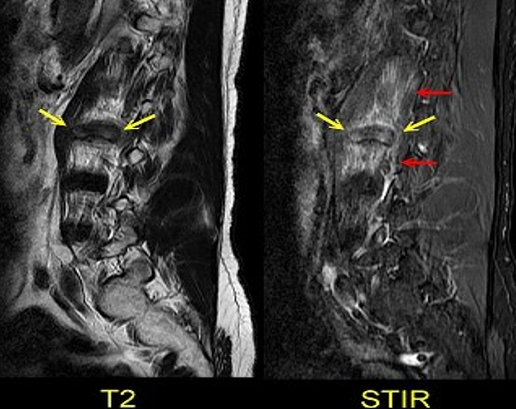 MRI Result — Wilmington, DE — Limestone Open MRI & Imaging Center