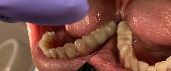 Close-up of a dog’s teeth and gums during a veterinary oral exam