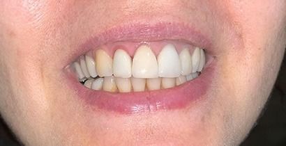 Close-up of a smiling mouth showing white teeth and pink lips