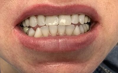 Close-up of a smiling mouth with visible teeth and lips