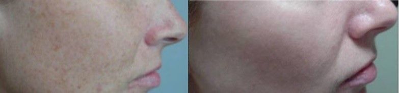 A man 's face is shown in two different angles.
