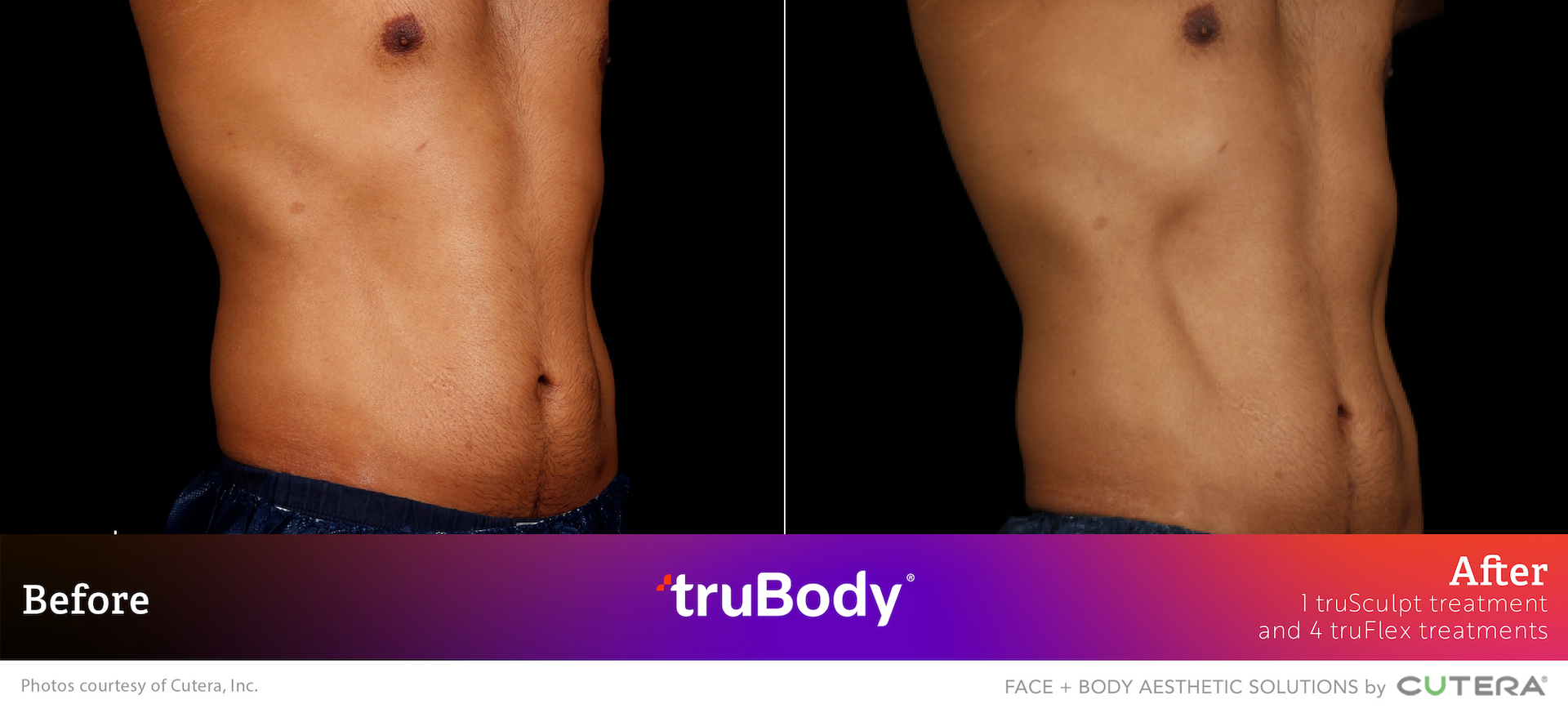A before and after photo of a man 's stomach.
