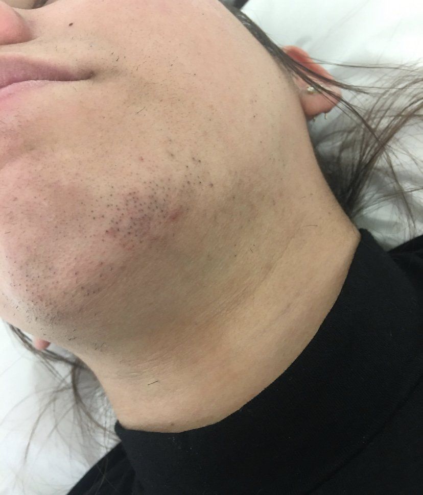 Primer plano de mandíbula y cuello con barba oscura y camisa negra.