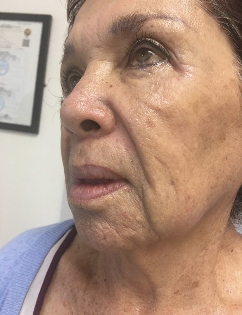 Mujer mayor con arrugas y manchas de la edad, con la mirada ligeramente levantada. Cabello oscuro, piel clara.