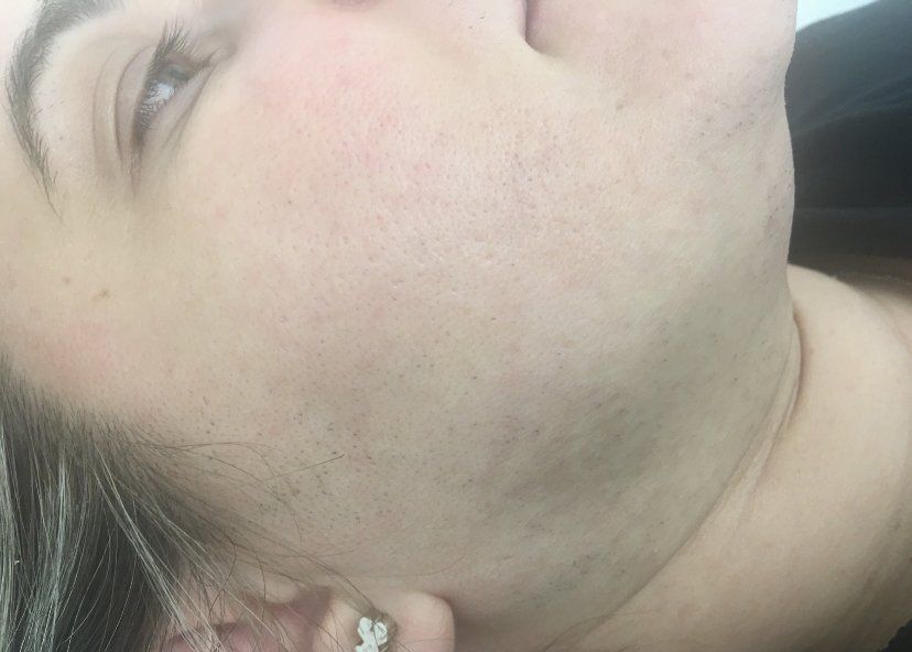 Rostro de mujer con vello facial oscuro en la barbilla y la mandíbula. Primer plano, piel pálida.