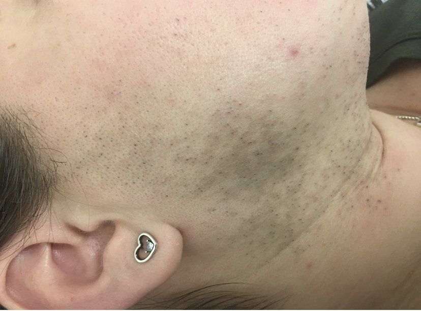 Primer plano de rostro y cuello con barba incipiente oscura y pendiente de plata en forma de corazón.