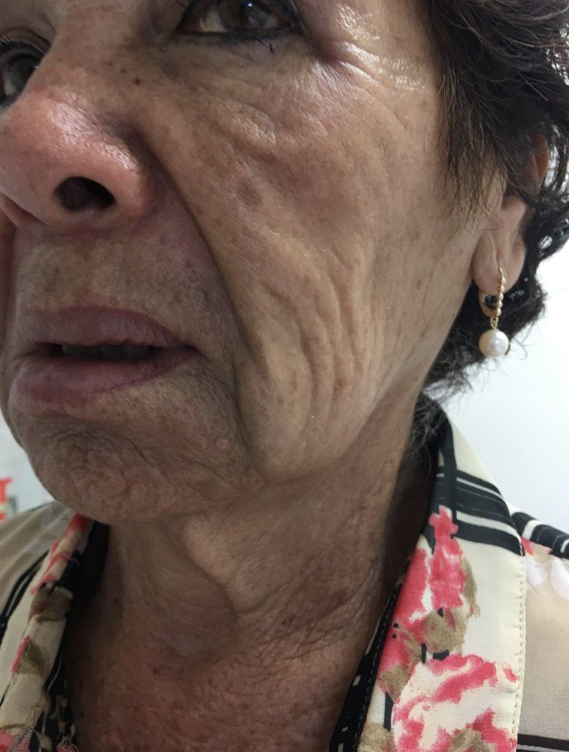 Mujer mayor, vista lateral, mostrando arrugas, con aretes y una camisa estampada.
