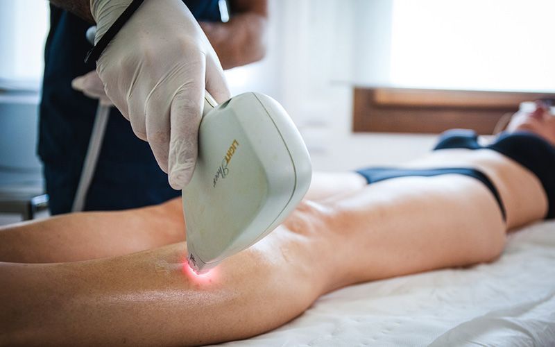Una persona si sottopone a un trattamento di epilazione laser su una gamba. Una mano guantata regge il dispositivo laser.