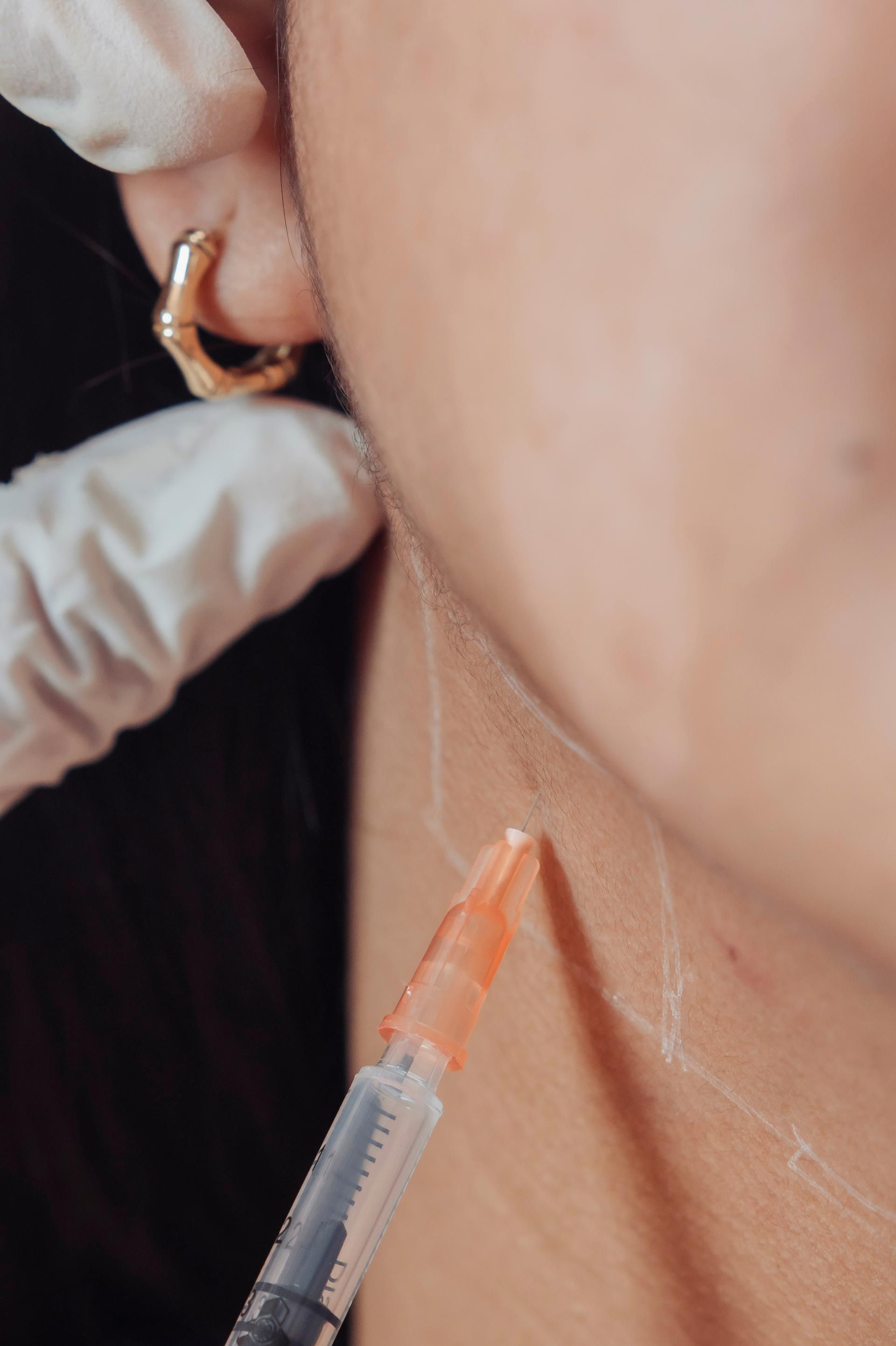 Syringe administering an injection into the side of a person’s neck or jawline