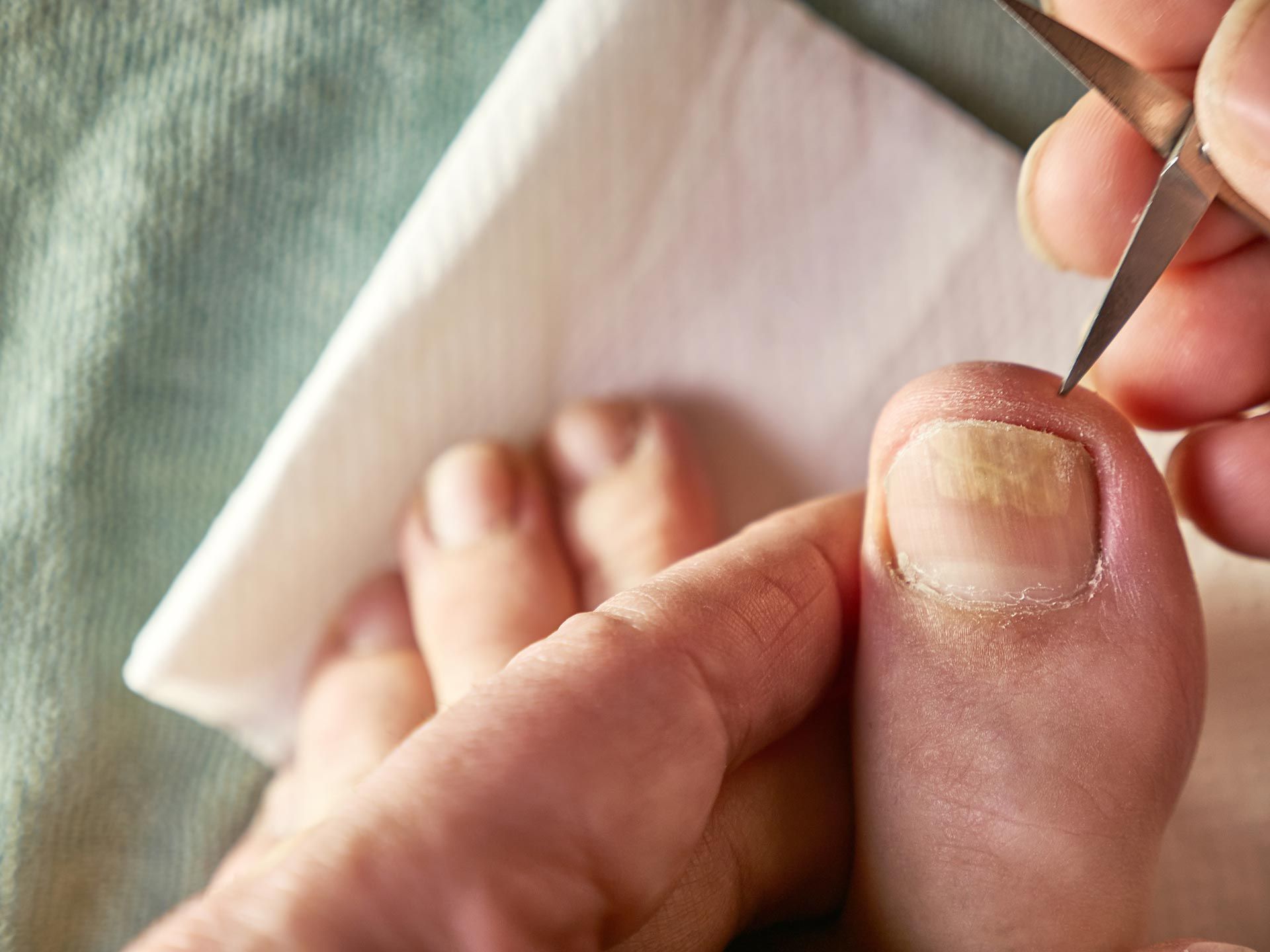 Close-up of a foot as a person trims a toenail with a small tool
