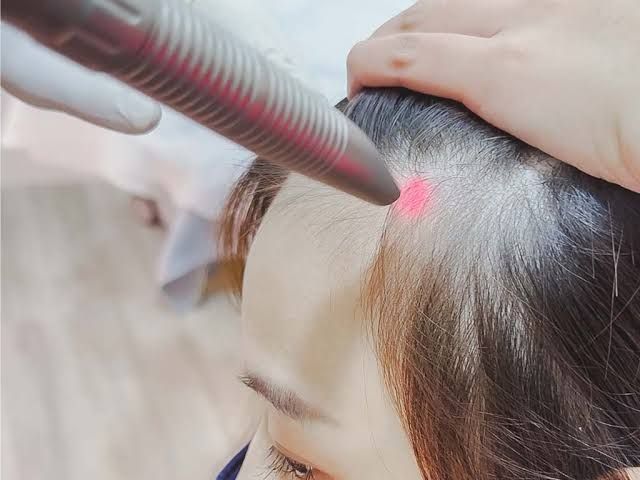 Gloved hands injecting medication into a shaved scalp during a medical procedure