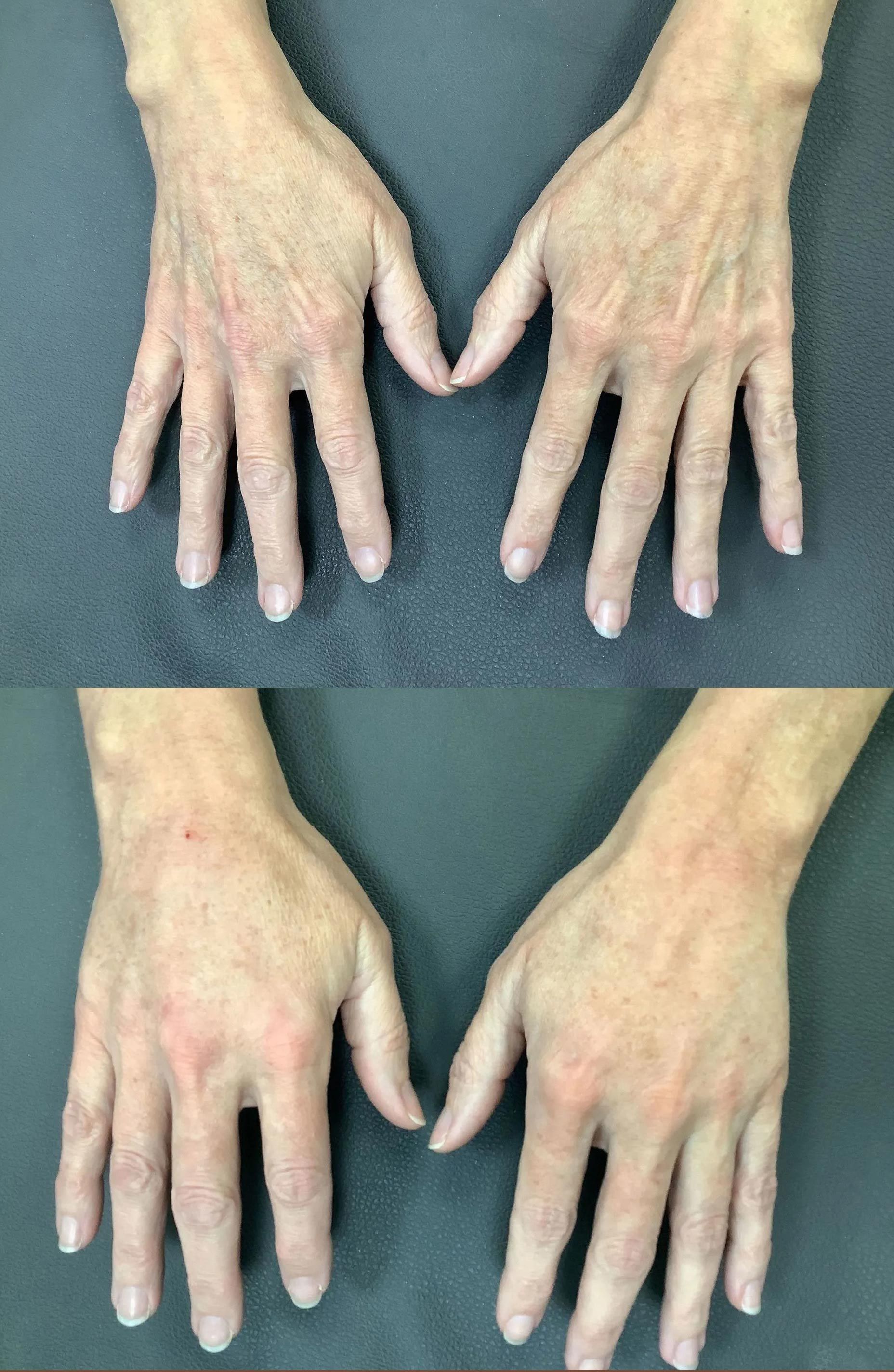 Two pairs of open hands on a blue background, showing the backs of the hands from above.