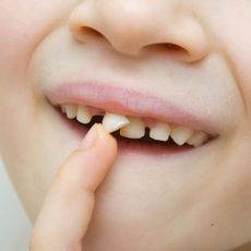 A close up of a child 's mouth with a missing tooth