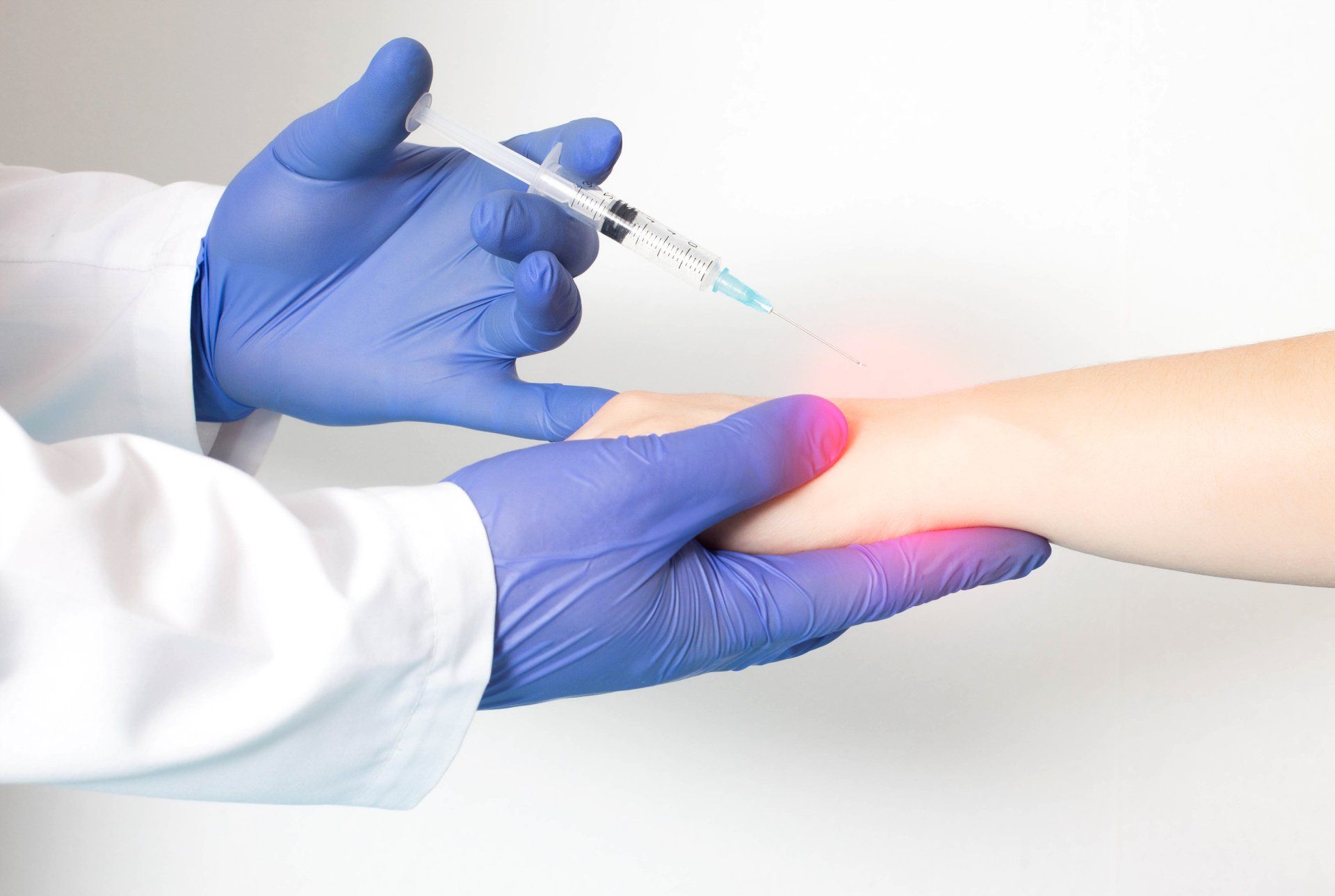 Ilustração para infiltracao com corticosteroides, para condição de Dedo em Gatilho
