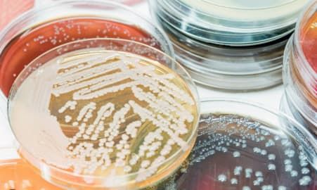 Testing and reading materials - Water Restoration in North Queensland