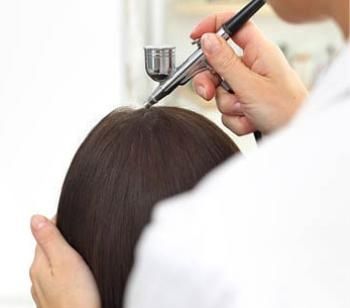 Specialista HairAid applica un trattamento tricologico su paziente: soluzioni per la salute dei capelli
