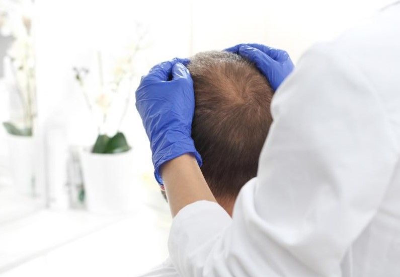 Specialista tricologico che esamina il cuoio capelluto prima di un autotrapianto FUE o Strip