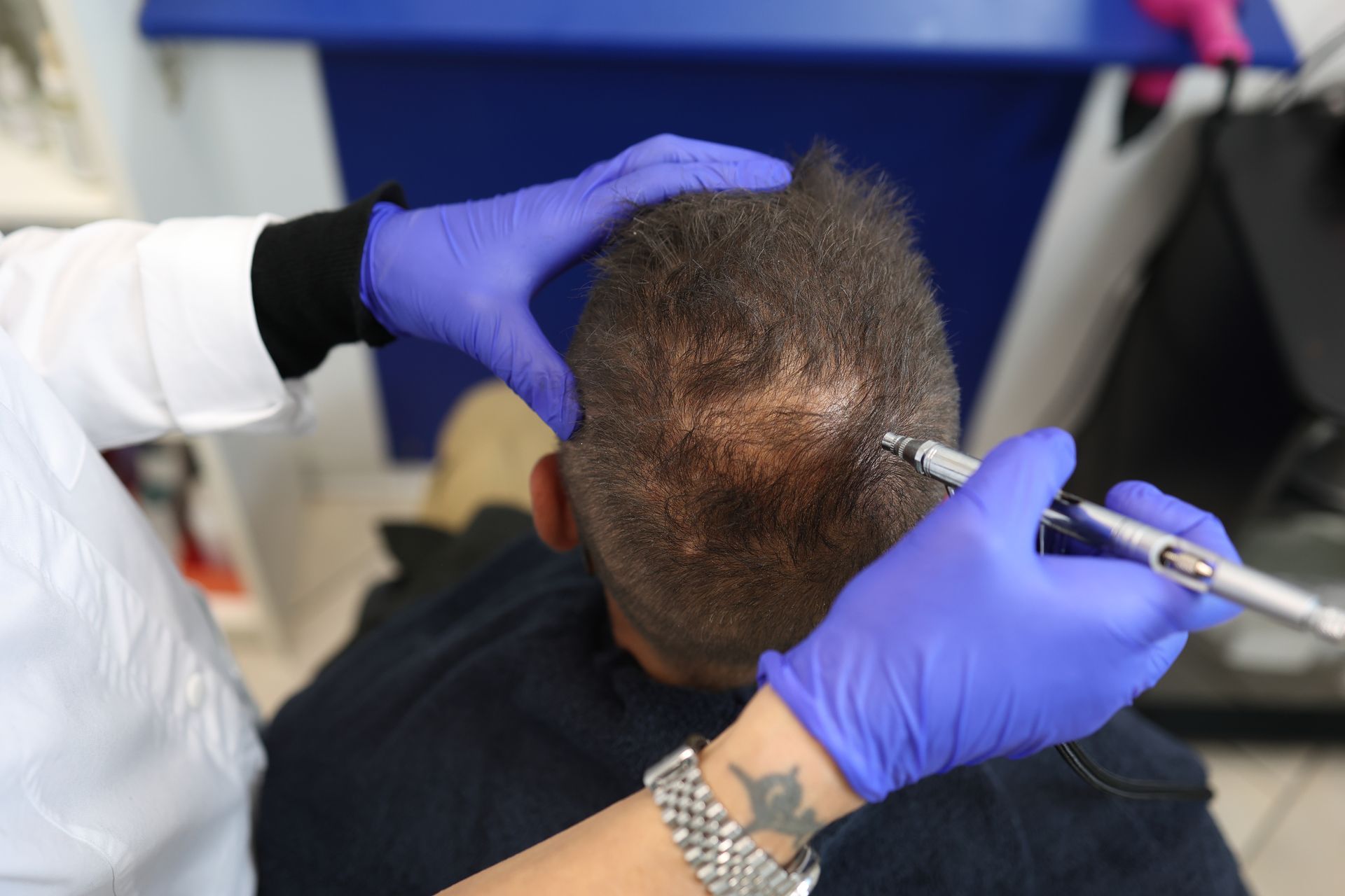 Specialista HairAid esegue un trattamento tricologico con dispositivo medico sul paziente