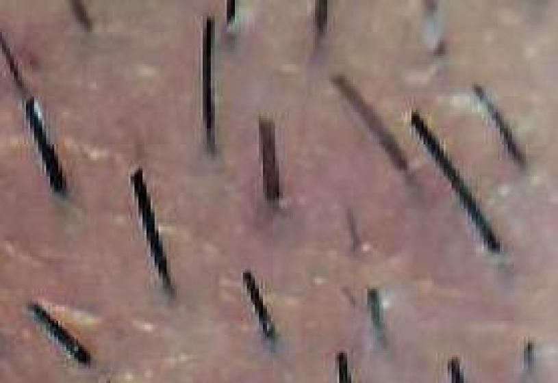 Primo piano del fusto del capello per l'analisi tricologica di problemi strutturali