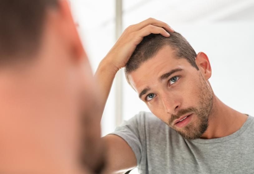 Uomo che si esamina allo specchio un lato del capo: cause e soluzioni per capelli che non crescono da un lato