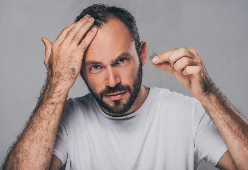 Uomo con barba e diradamento che esamina un ciuffo di capelli spezzati tra le dita: 5 rimedi ai capelli che non crescono