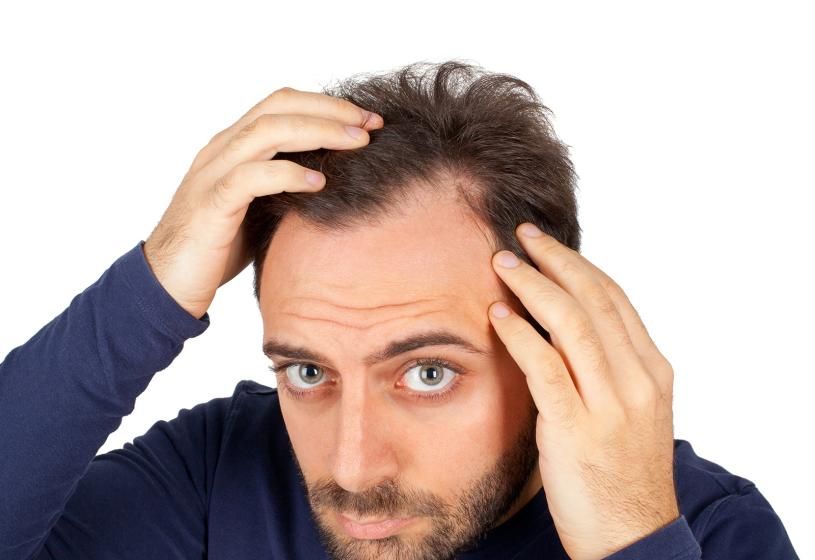 Uomo giovane con barba che controlla la stempiatura e il diradamento frontale: 3 rimedi contro la stempiatura