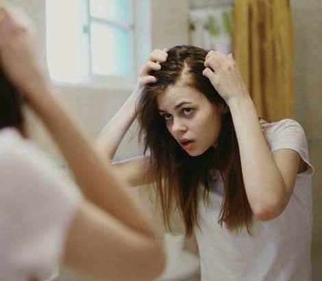 Ragazza giovane che esamina preoccupata il diradamento alla radice: alopecia ereditaria femminile,cause genetiche e soluzioni