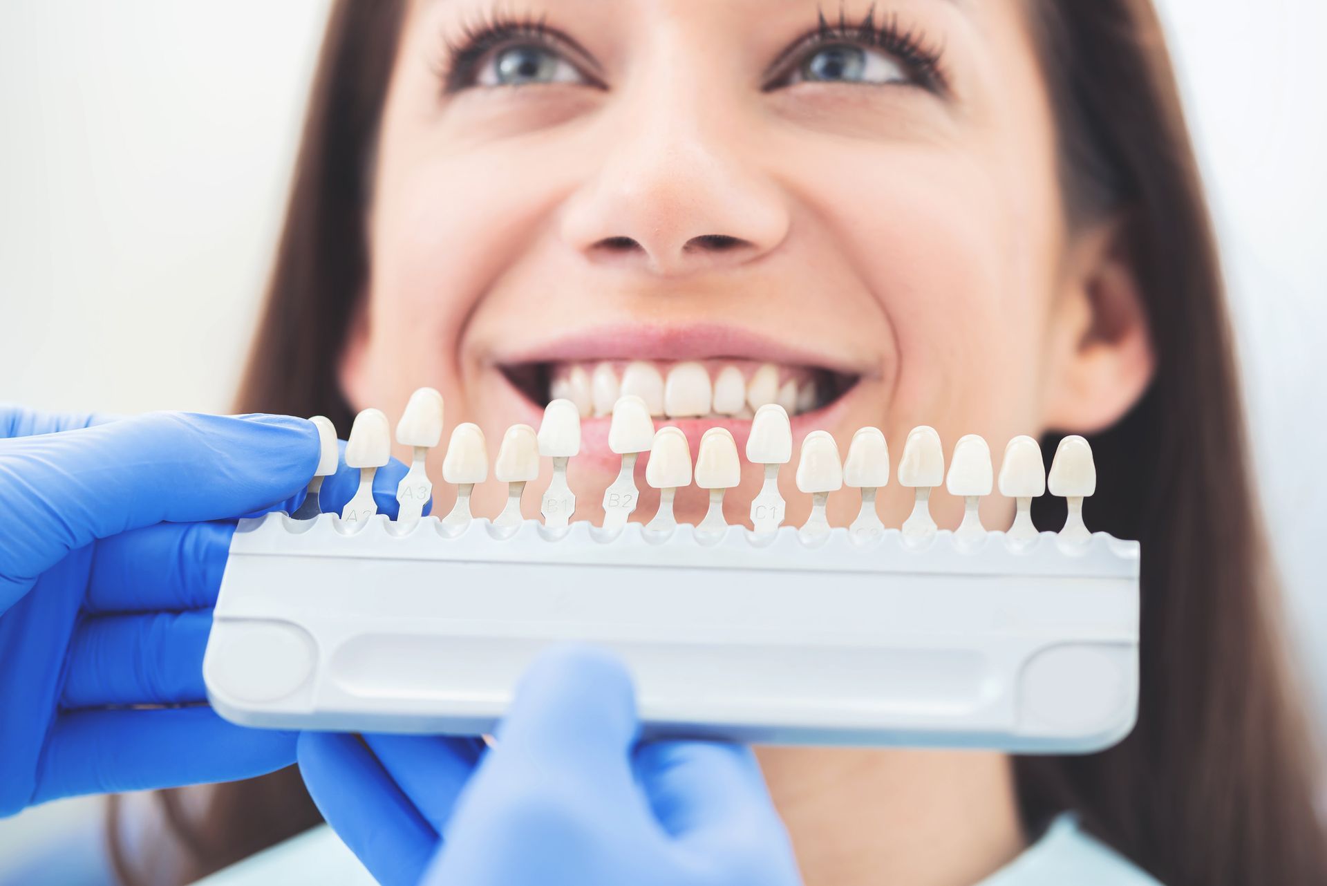 Teeth Replacement - Charlotte, NC - Northlake Dentistry