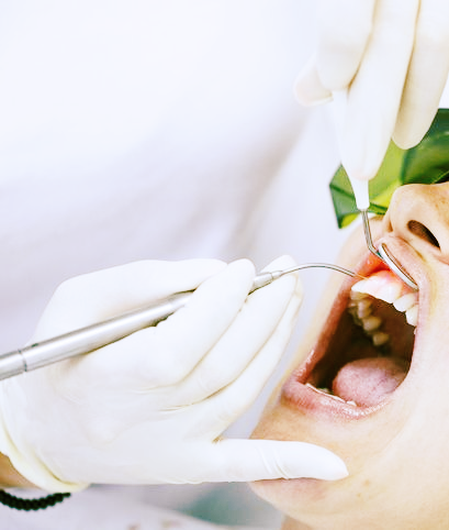 Laser Dentistry - Charlotte, NC - Northlake Dentistry