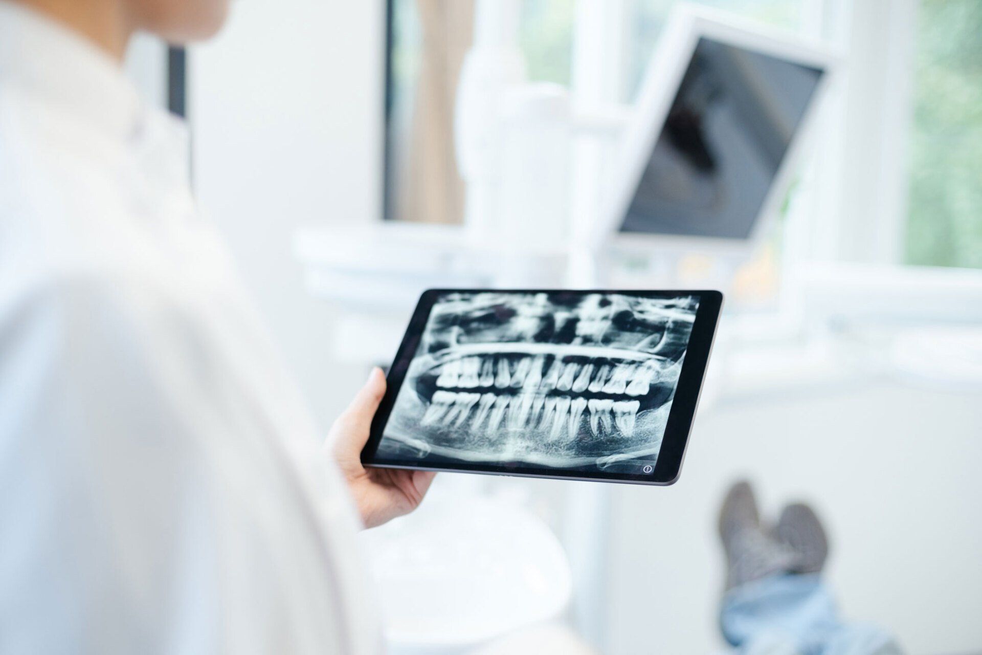 Digital X-Rays — Petersham, NSW — Petersham Dental Practice