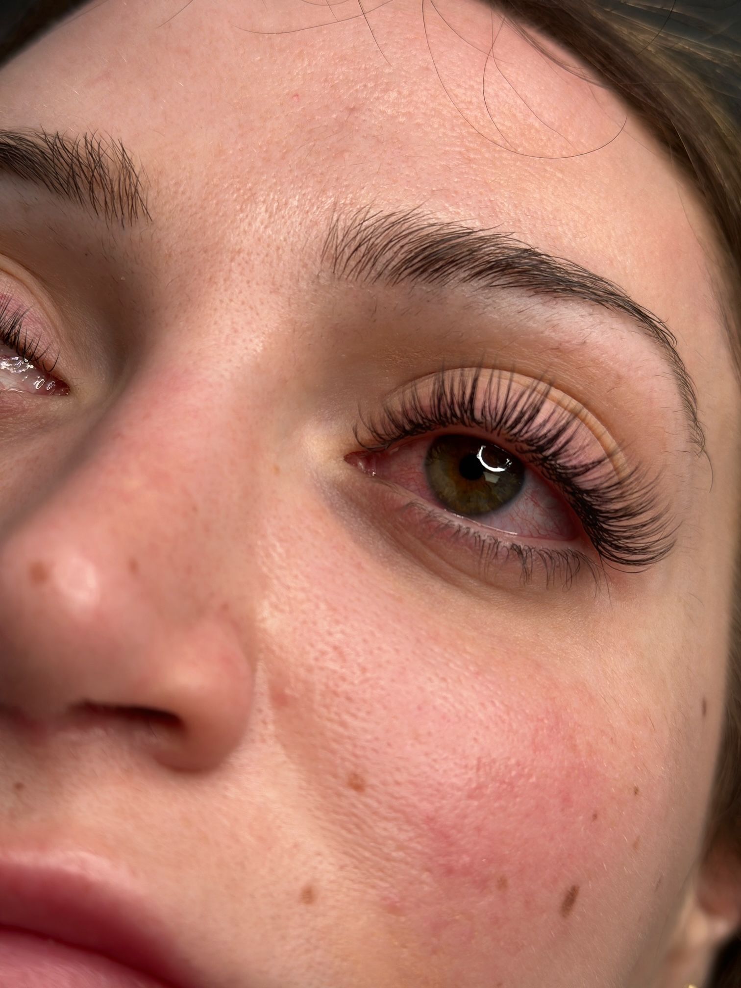 Close-up of a person's eye with long, dark eyelashes. Redness around the eye with drawn-on eyeliner.