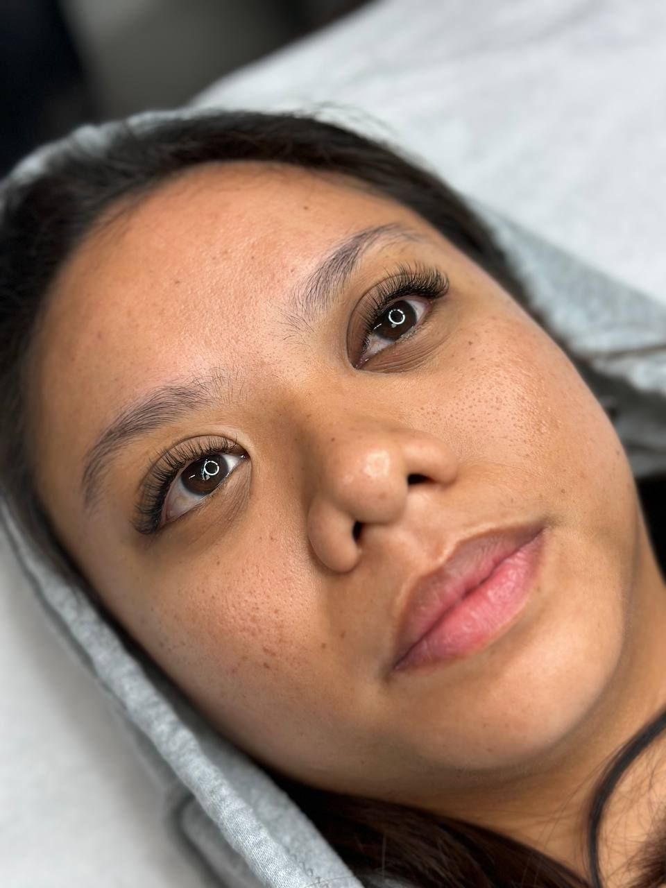 Woman with newly tattooed eyebrows and freckled skin, eyes open, lying down.