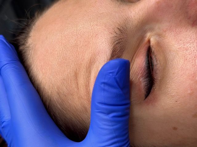 Person's eye closed with a dark eyeliner line; blue-gloved hand touches the skin.