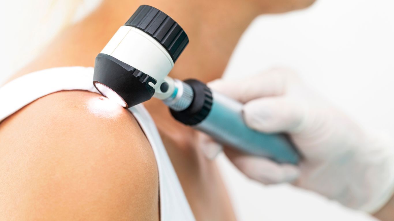a Healthcare Professional Using a Dermatoscope to Examine a Mole — Tewantin Medical Centre In Tewantin, QLD