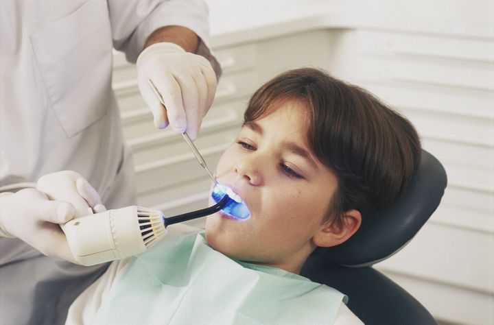sorriso prima e dopo lo sbiancamento dentale