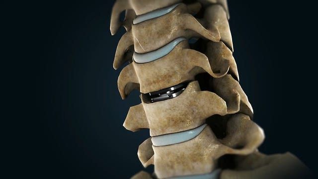 Pituitary