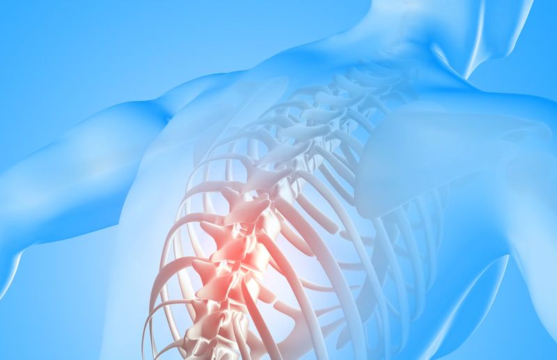 Herinated Disc