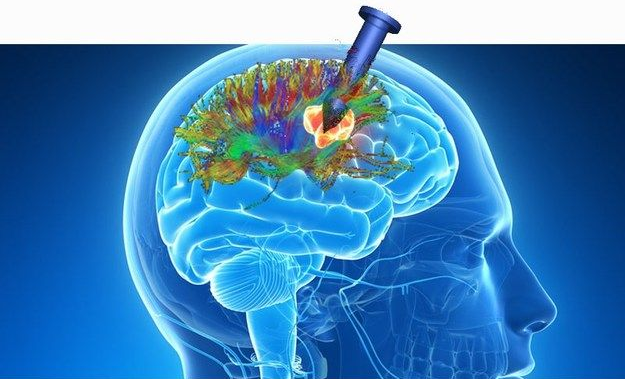 Pituitary