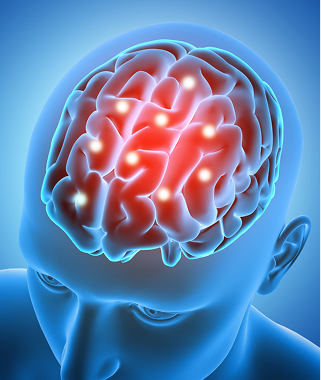 pituitary tumors