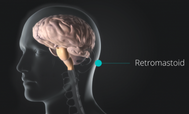 Pituitary